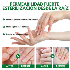 7 Days Fungus Free Nails® - Protege y elimina el hongo de tus Uñas (50ml)
